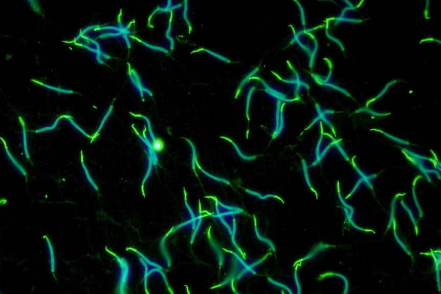 Fluoroescently labelled crocodile sperm