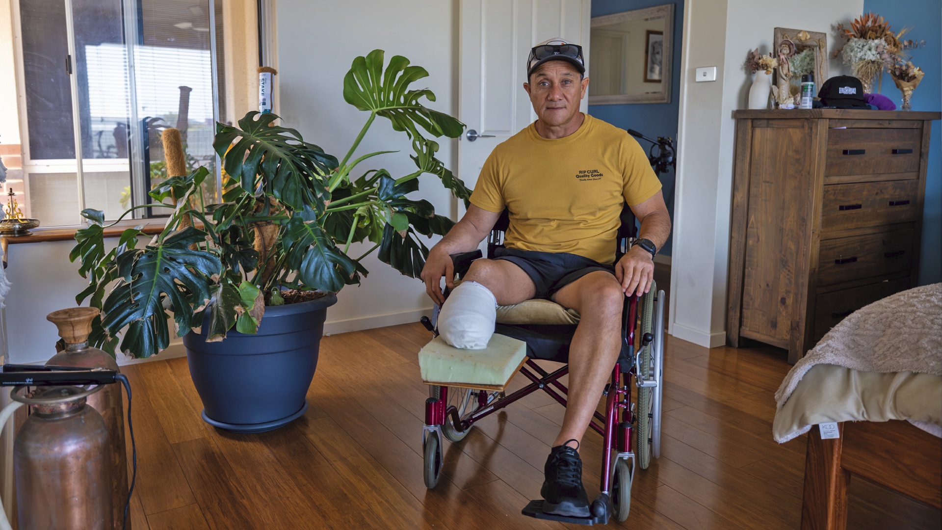 Man in wheelchair missing lower limb