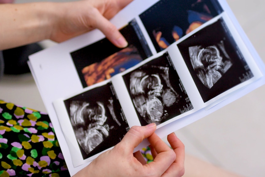 A woman's hands holding some baby scans.