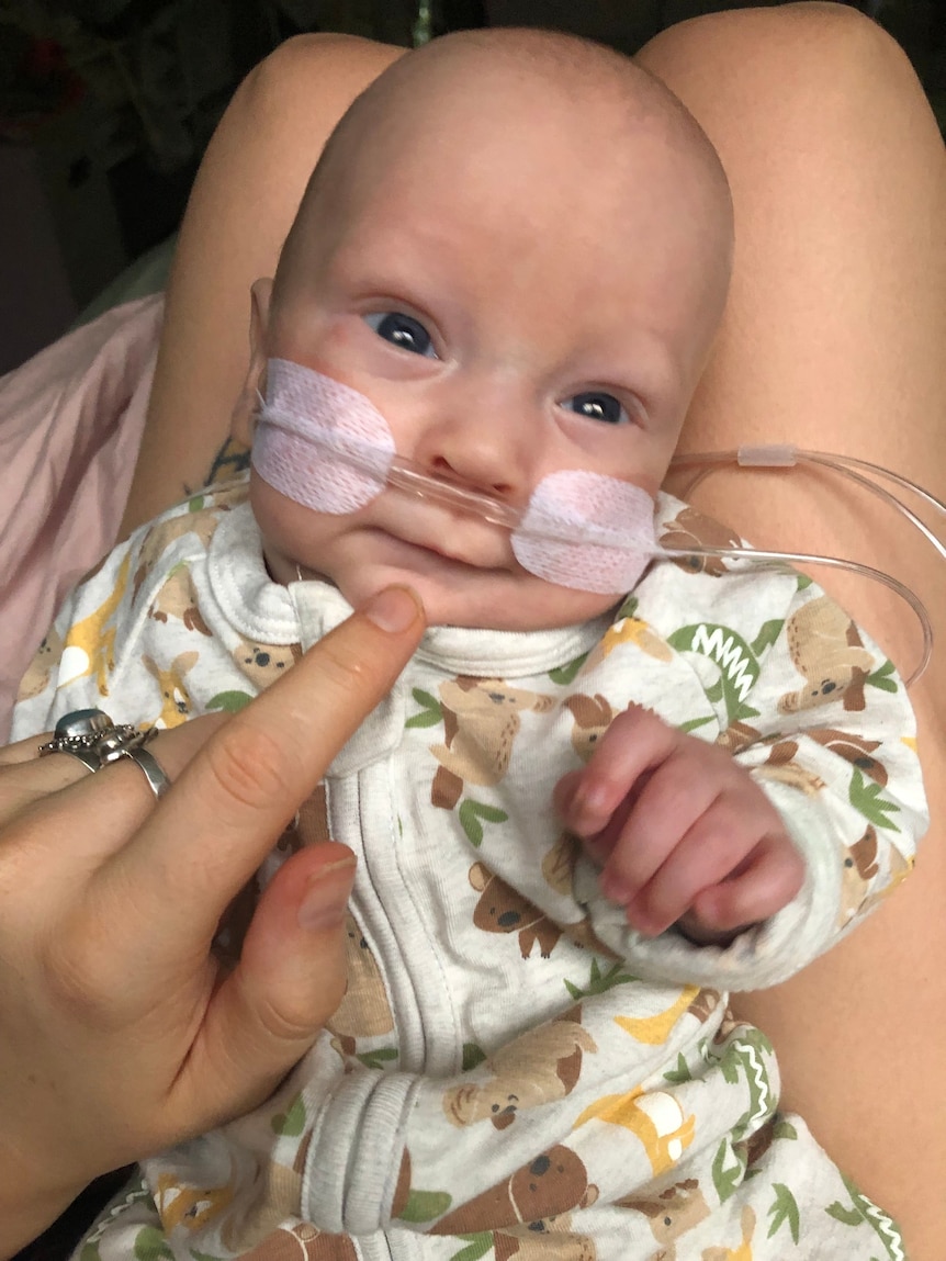 Rafferty Robb, who was born premature, out of crib with tubes on his face