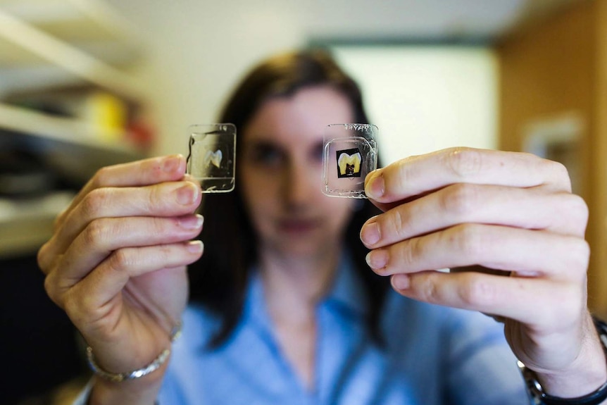 Dr Tanya Smith with tiny slivers of teeth