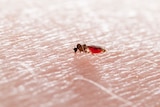 close up of biting midge on a person's skin with the stomach filled with blood