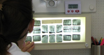 Health professional studying dental xrays