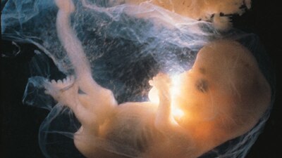 File photo: Human embryo (Getty Creative Images)