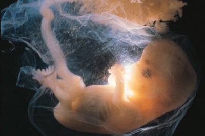 File photo: Human embryo (Getty Creative Images)