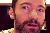 Hugh Jackman posts on Instagram after having a skin cancer removed.