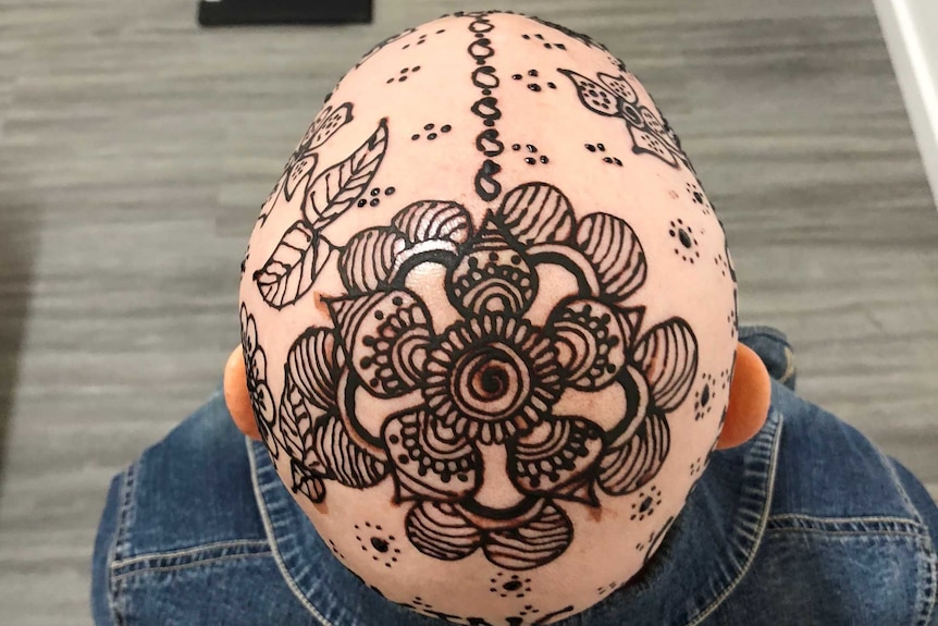 Henna crown, painted on a woman's bald head.