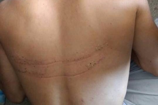 A refugee on Manus Island, who says his injuries were caused by police.