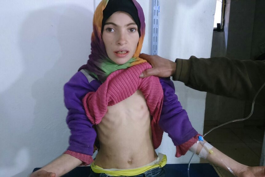 Girl starving in Madaya