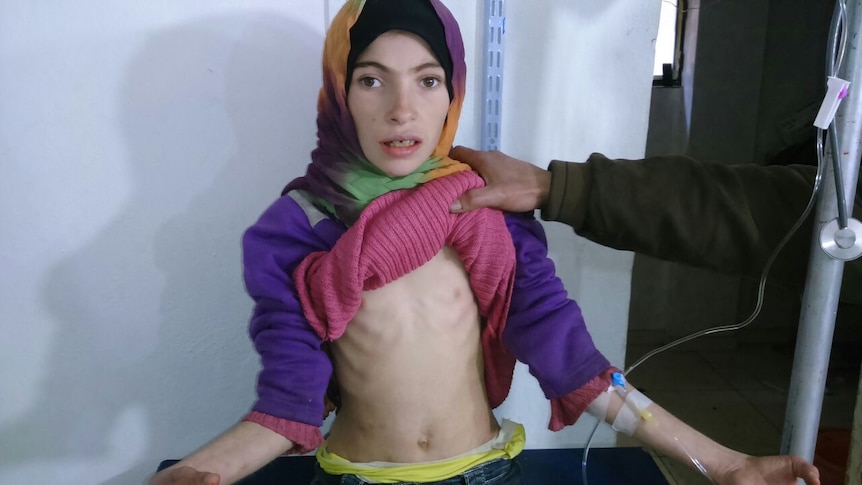 Girl starving in Madaya
