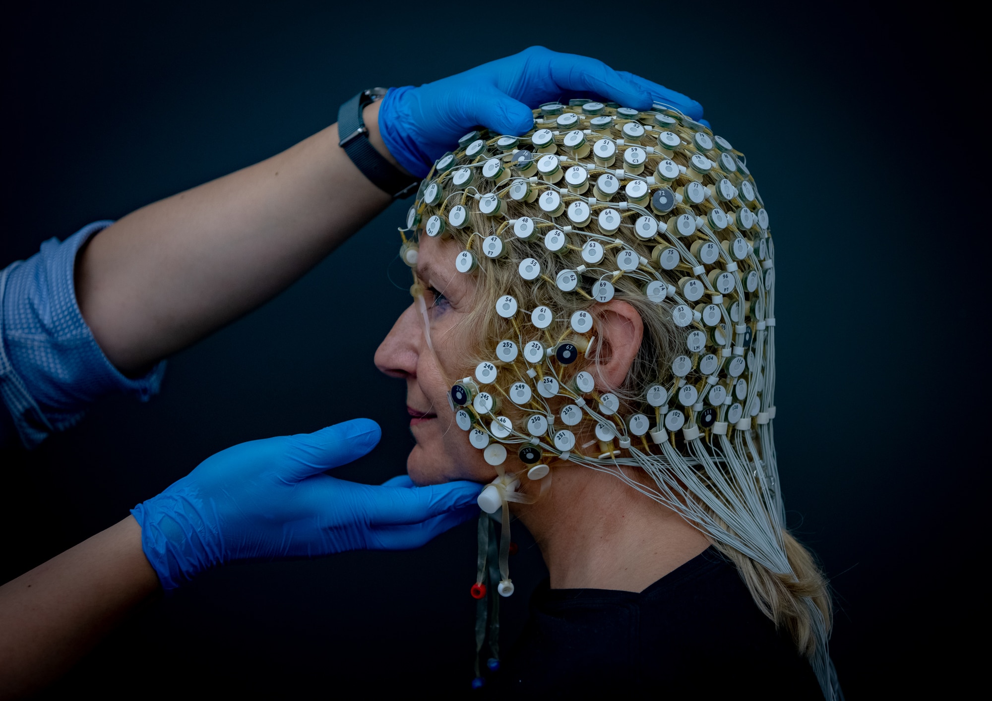 A side profile of Fran, wearing a cap of 250 small elecrodes and wires, while a man wearing blue gloves holds her head.