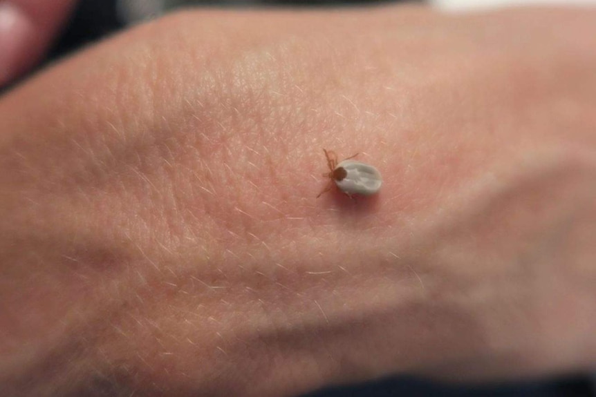 A paralysis tick on someone's hand