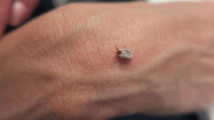 A paralysis tick on someone's hand