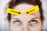 A young woman with a pimple on her forehead and arrows pointing at it