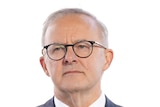 Anthony Albanese in a suit and beige tie with his hands up in the air standing in front of a microphone