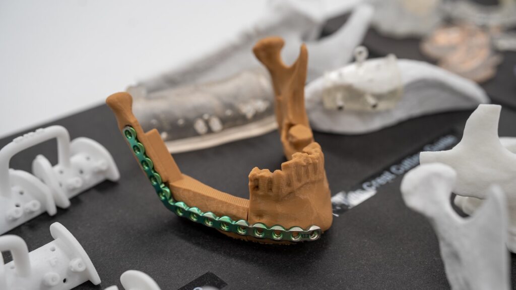 abc.net.au - Stephanie Dalzell - The healthcare system anomaly threatening to financially cripple cancer survivors