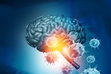 A graphic depicting Covid in the brain.