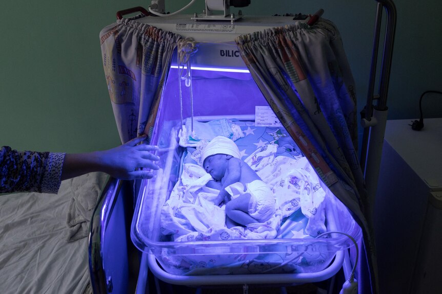 A baby is pictured in a hospital crib with blue light shining on her. 