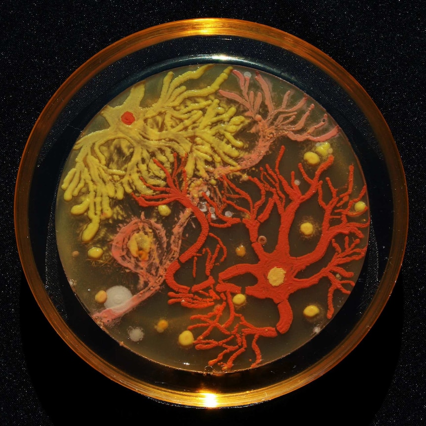 Agar Art winner Neurons