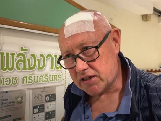 Jerry being interviewed with a bandage on his bald head and glasses. 