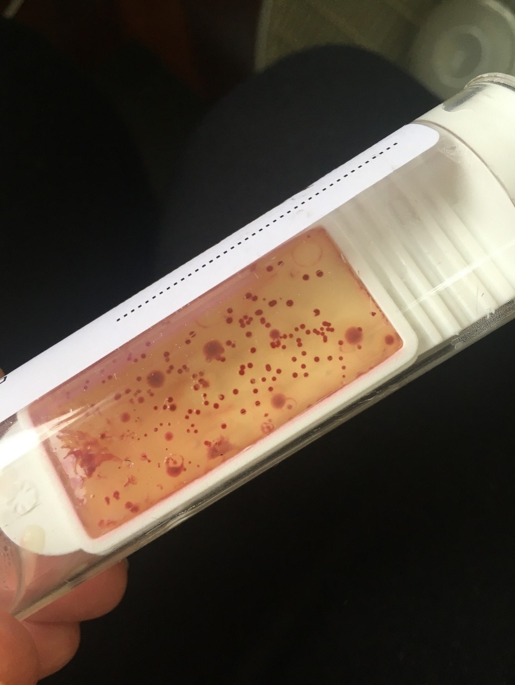 A close up of bacterial spots on a measuring stick