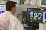 A man in medical protective gear looks at a computer with scans of brain with various degrees of dementia.