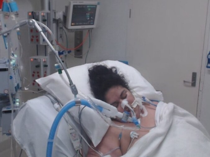 Woman lying in hospital bed in ICU with ventilator