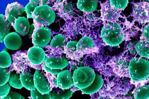 对抗生素的不当使用造成了超级细菌数量的增加。