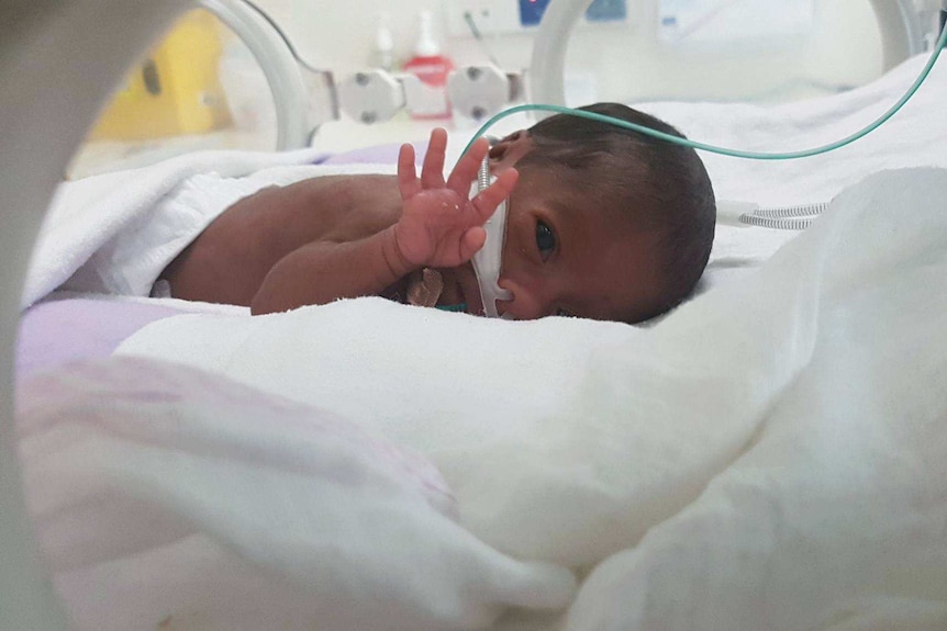 A tiny prematurely-born baby holds up her hand while in the incubator.