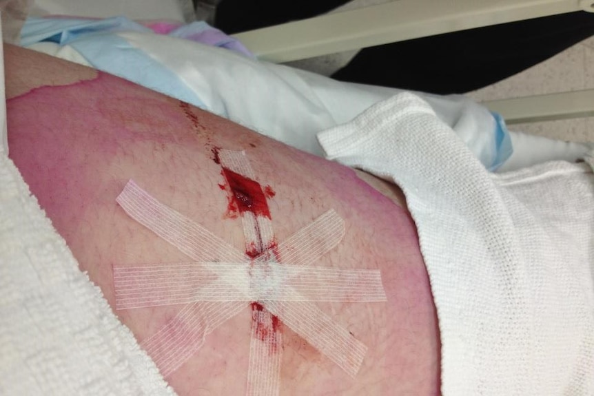 Daisy Hoskins' 2012 muscle biopsy.