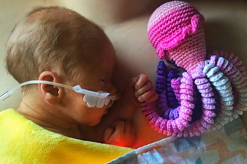 A newborn baby with a medical tube in her nose.