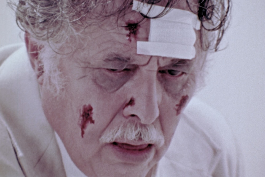 Film still of Lincoln Maazel with a bandage on his forehead and cuts on his face in The Amusement Park
