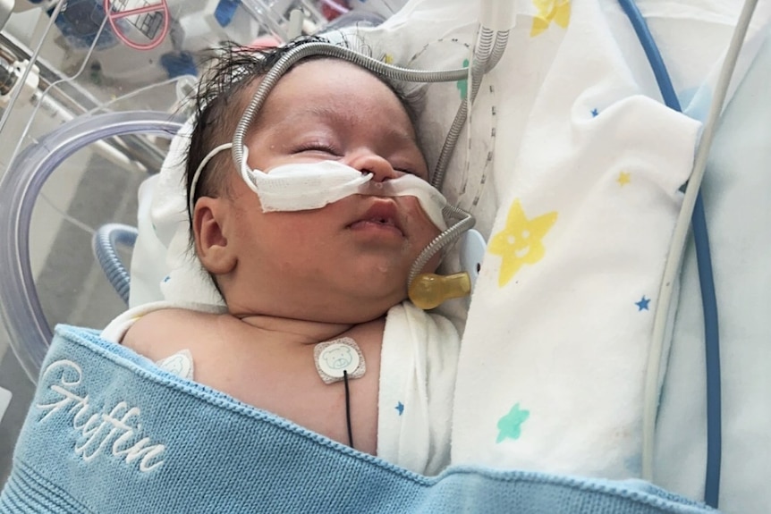 A small baby wrapped in a blanket. He is sleeping and his face is obscured by a dummy and nasal feeding tube