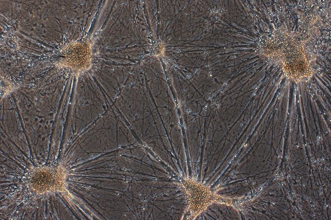Neurons under microscope.