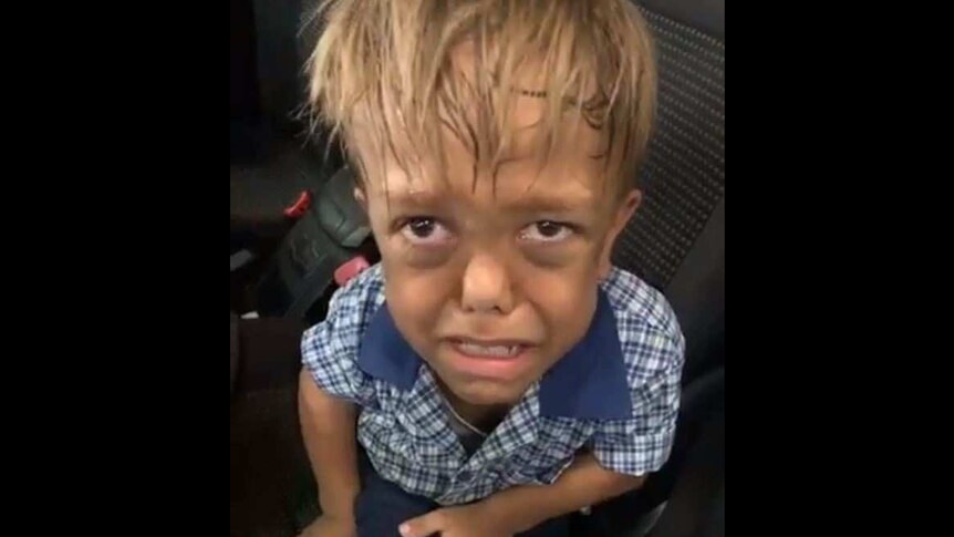 Young Indigenous boy Quaden Bayles looks into the camera with tears in his eyes while sitting in a car