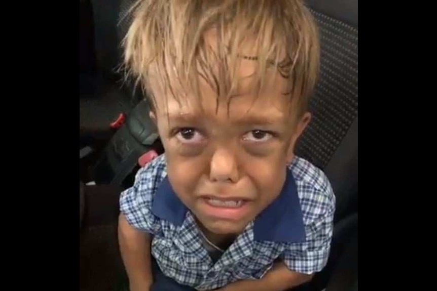 Young Indigenous boy Quaden Bayles looks into the camera with tears in his eyes while sitting in a car.