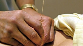 A patient undergoes acupuncture treatment on their stomach.