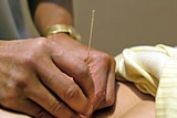 A patient undergoes acupuncture treatment on their stomach.