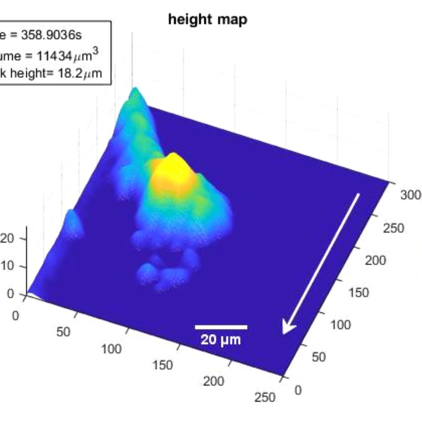 A coloured 3D image measuring a blood clot.