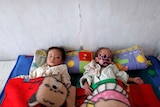 Malnourished children in North Korean hospital