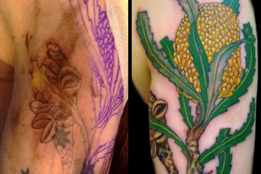 Before and after tattoo