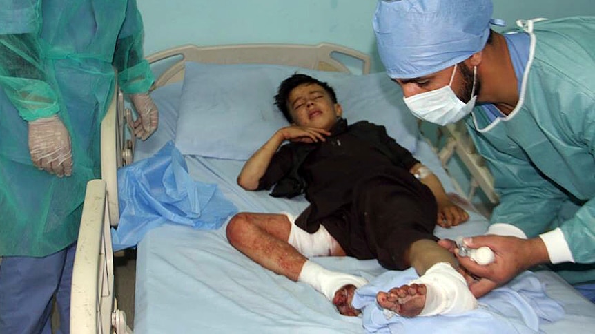 Doctors treat a boy on a hospital bed with bandages and wounds on his legs.