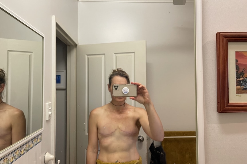 A woman takes a photo of her bare chest after a double mastectomy