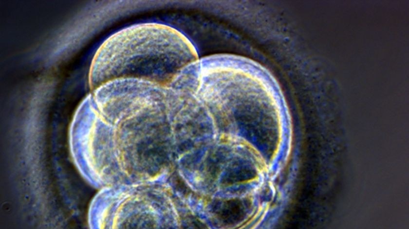Cloned human embryo, created at Centre for Life in Newcastle upon Tyne in England, in May 2005.