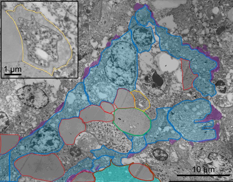 Electron microscope image of malaria parasite in spleen tissue