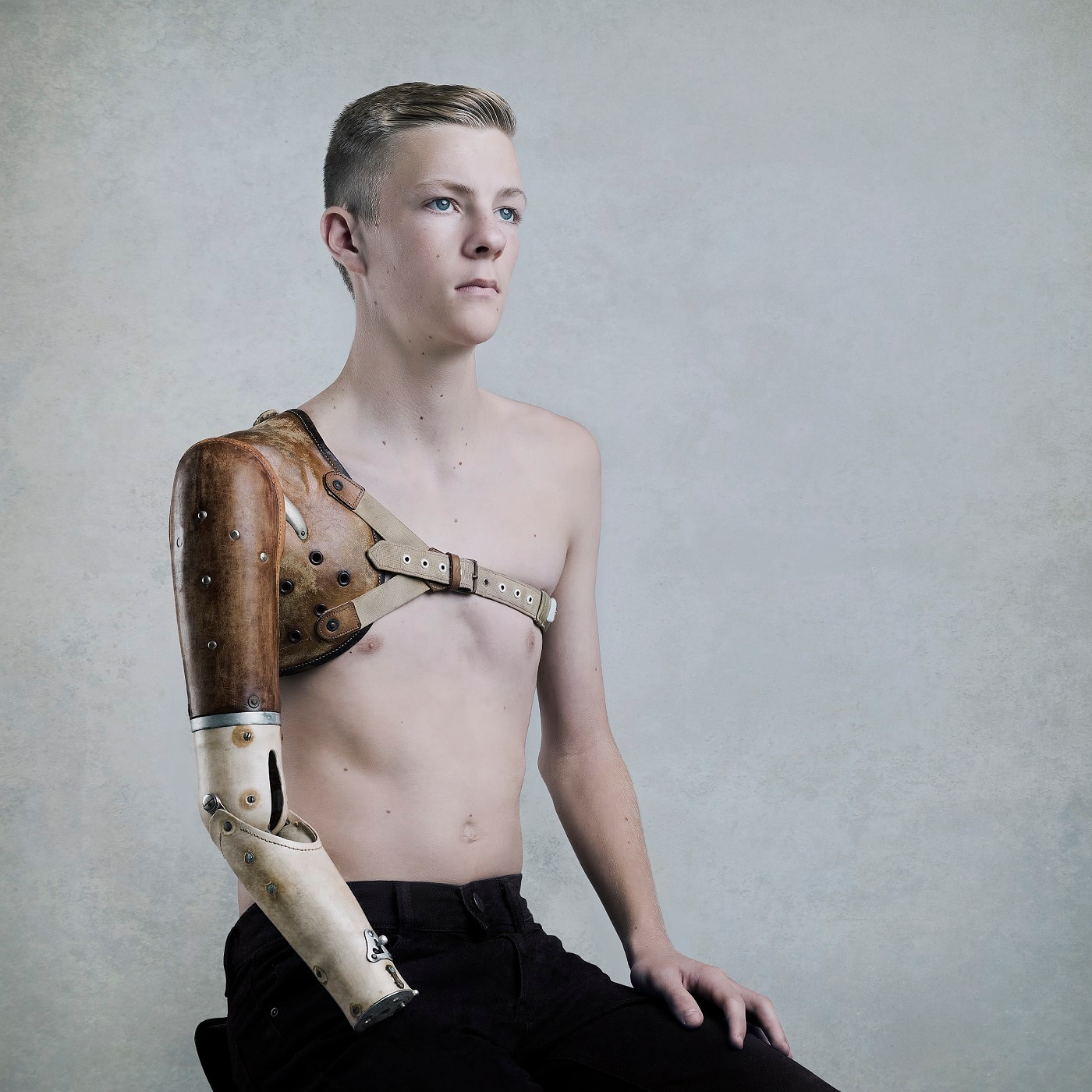 A young man sits shirtless wearing a prosthetic arm.