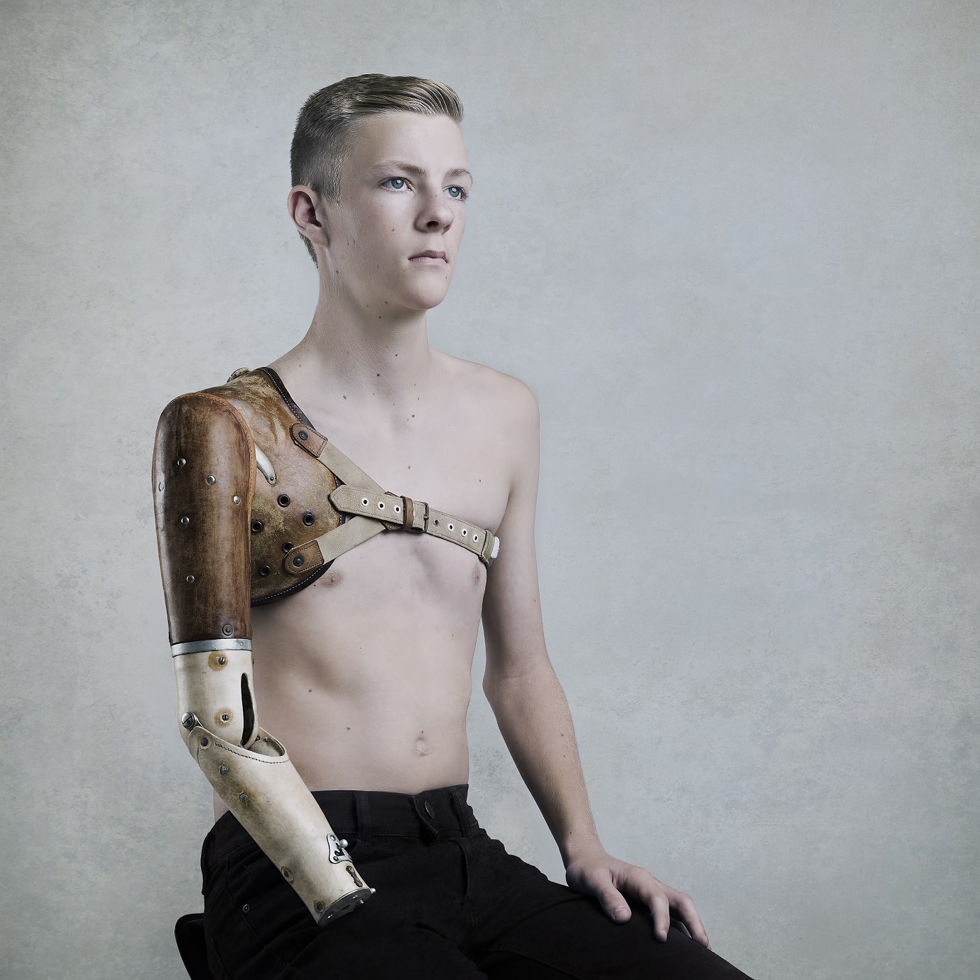 A young man sits shirtless wearing a prosthetic arm.