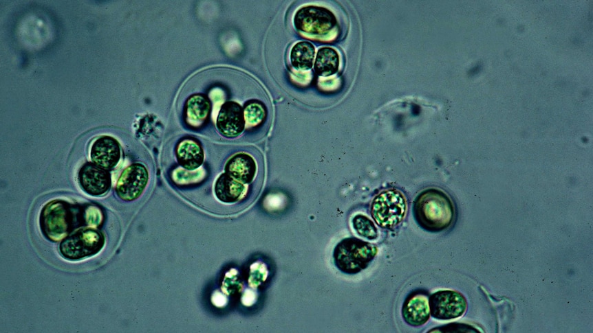 Close up of cyanobacteria