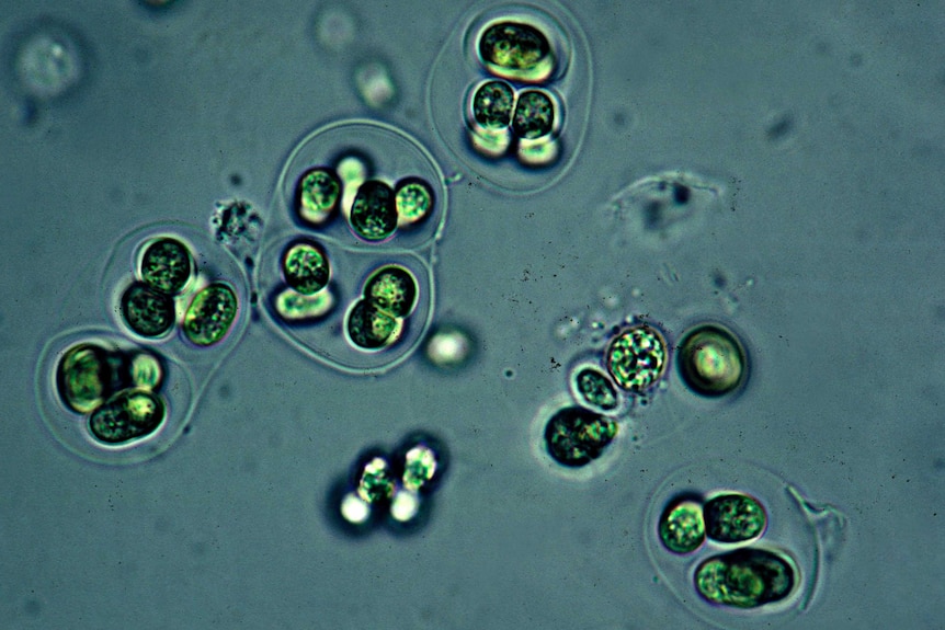 Close up of cyanobacteria