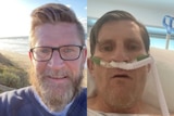 A composite image shows Richard smiling at the beach on the left and in hospital on oxygen supply on the right.